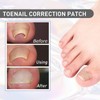 MFCGHXR Ingrown Toenails Tool Set 124 Pieces Toenail Correction Patch,