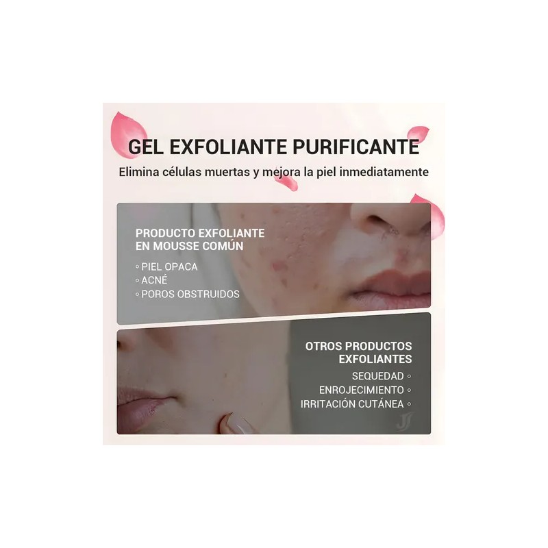 2pcs Purificante Exfoliante, Gel Exfoliante Avanzado 100ml