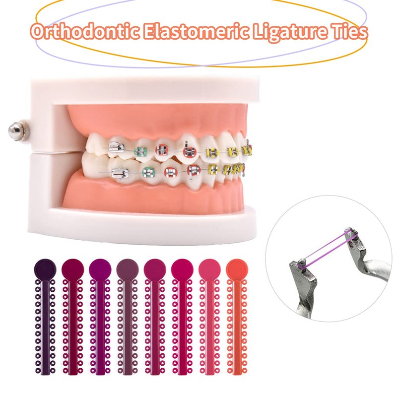 1040 Pcs Multicolored Braces Rubber Bands Orthodontic Ligature Ties O-Rings