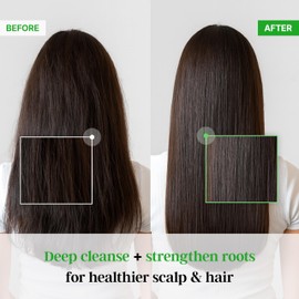 Olive TS Treatment (17.6 Fl Oz / 500mL) | Treatment of Damaged Hair and Dry Scalp and Hair | Olive Oil Hair Treatment - Hydrating and Restorative| Silicone Free | All Hair Types