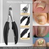 Fuwddy Ingrown Toenail Clipper Nail Cutter Pedicure Knife Thick Nail