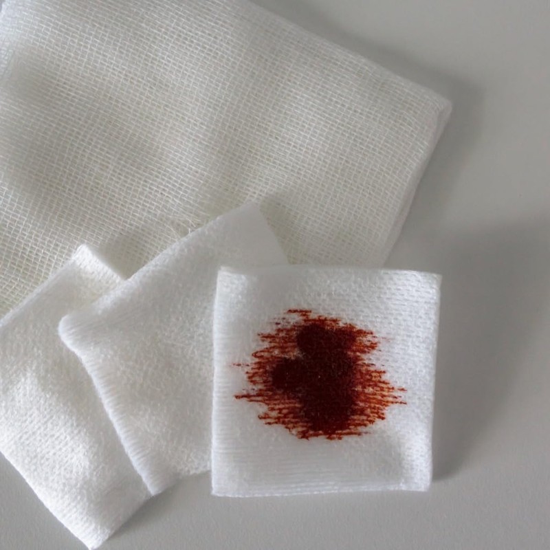 Non-Sterile Gauze Pad - Non-Woven 4 Ply Highly Absorbent Gauze