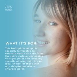 Hey Honey Skincare Be Clear - Acne Control Deep Pores Cleansing Gel | Propolis, Green Tea Oil, Camellia | Exfoliates, Unclogs Pores, Balances Oil Production | Fast Acting & Long Lasting | 2.7 Oz
