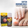 URIEL UPGRADED Ingrown Toenail Treatment, Ingrown Toenail Removal Kit, Ingrown