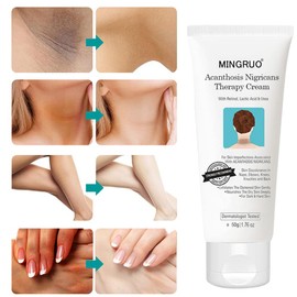 MINGRUO Creme zur Korrektur dunkler Flecken und Acanthosis Nigricans Therapy Cream, Entfernung von Hyperpigmentierung für dunkle Körperteile, Dark Spots Corrector Creme Remover