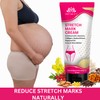 INTIMIFY Stretch Mark Removal Cream For Women, Stretch Mark Cream