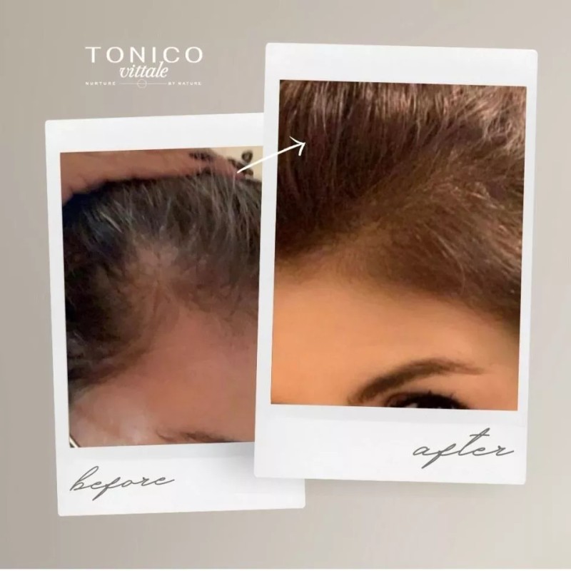 Tonico Vittale Crema Para Peinar Cabello Reparador Sellador Tonico Vittale