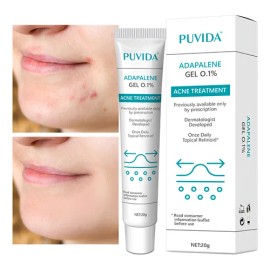 Crema Antipolvo De Dilución De Marcas De Acné 20g