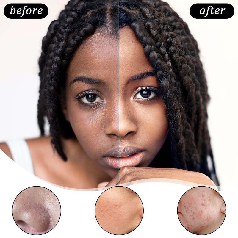 6 Pcs Concealer Brush Under Eye Eyeshadow Applicators Flat Concealer