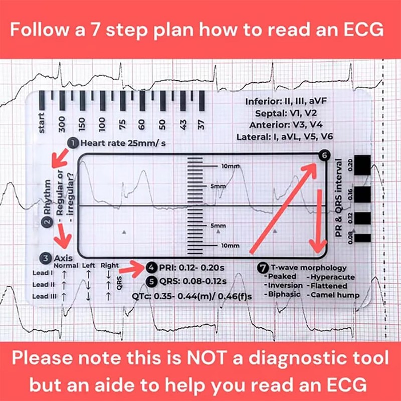 1Pc ECG 7 Step Ruler, ECG 7 Step Ruler for