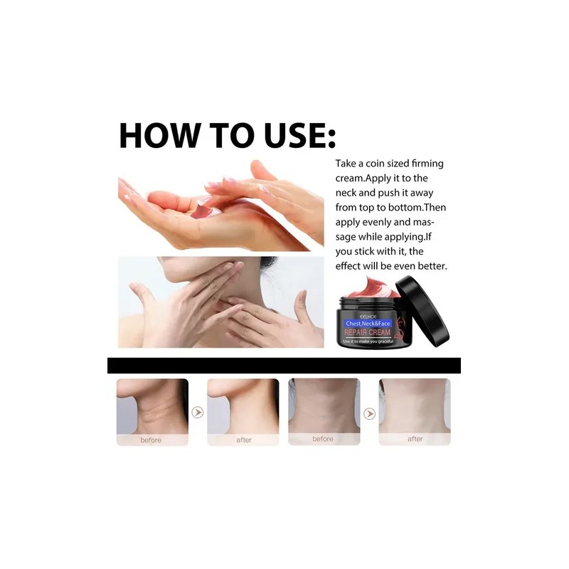 Eelhoe Crema Antiedad Para Rostro Cuello y Pecho Elimina Manchas