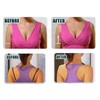 Abi & Ash 4 Racer Back Bra Clips Cleavage Enhancer