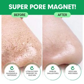 Mitesserentferner Stripes, 25 Stück Natürliche Bambuskohle Mitesser Entferner, Zum Entfernen von Mitessern und Zum Freimachen verstopfter Poren (Mitesserentferner Porenreinigerr für Männer und Frauen)