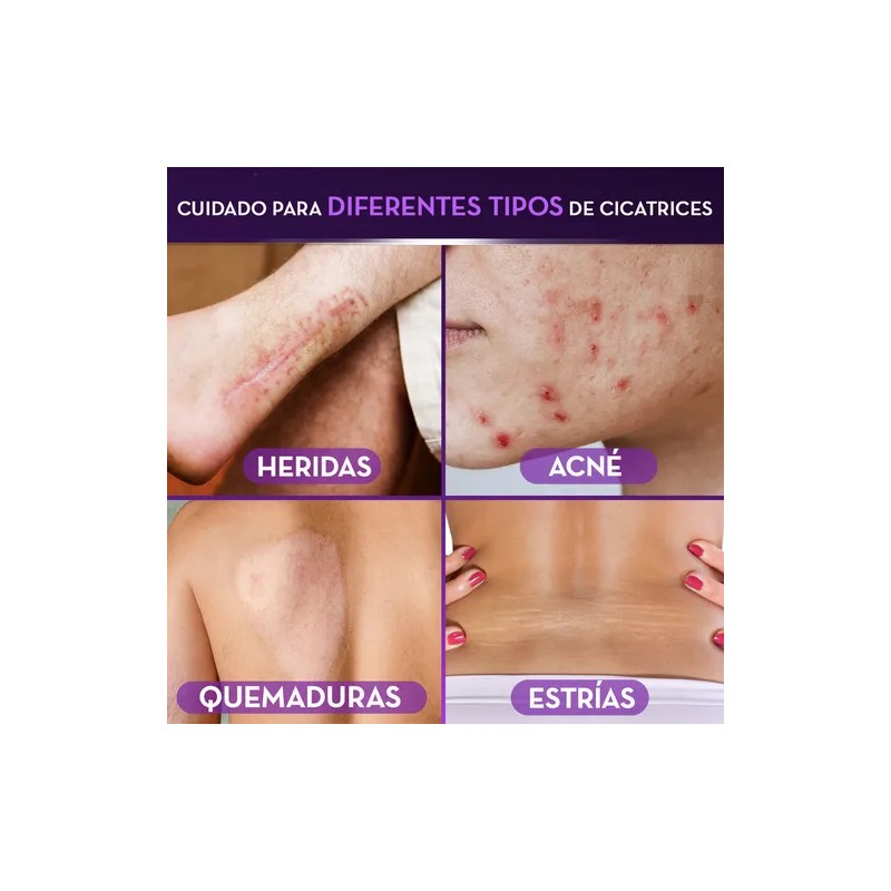 Pack x2 Gel Cicatrices 60g + 30g Cicatricure