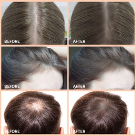 Boobeen Hair Shadow Powder Kit, Root Touch Up Powder Cover Hair Color, Temporary Concealer Powder with Brush for Gray Hair Root