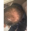 Cáp. Anticaída De Cabello, Fortalece Y Reestructura
