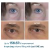 Contorno De Ojos Eyephalt Eyecream For Eyebags De Dr.melaxin Todo