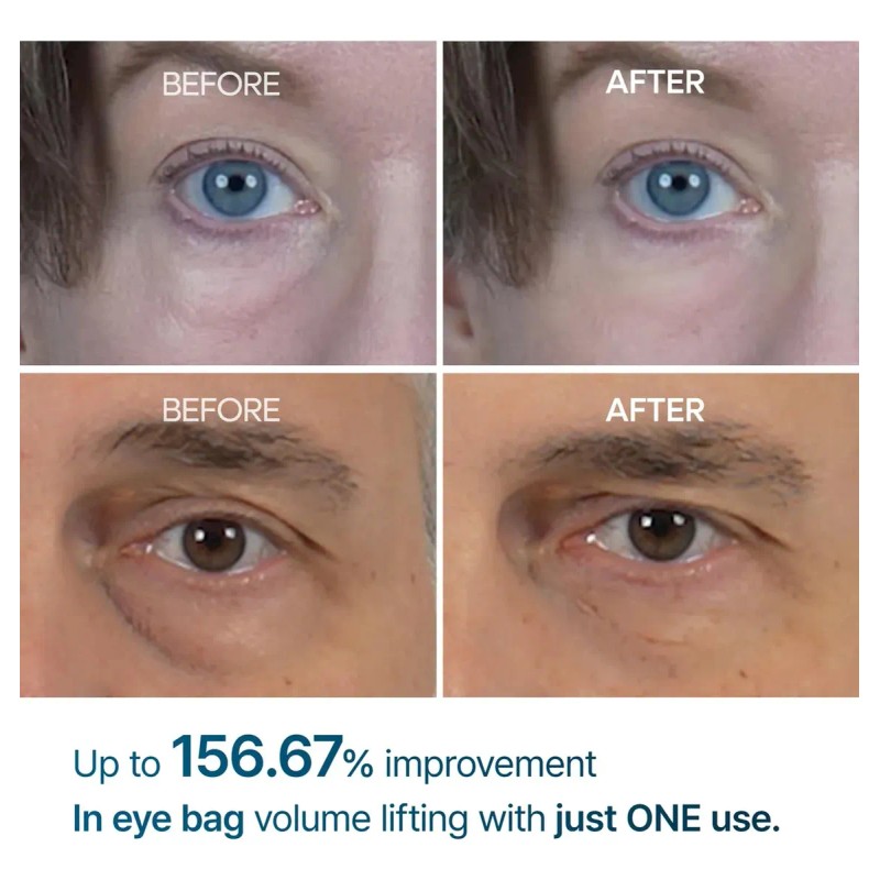 Contorno De Ojos Eyephalt Eyecream For Eyebags De Dr.melaxin Todo