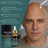Crema Hidratante Hialurónica Para Cuero Cabelludo Bald Care