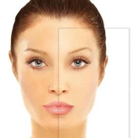 Avon Anew Tónico Facial Iluminador Con Vitamina C Momento de aplicación Día/Noche Tipo de piel Todo tipo de piel
