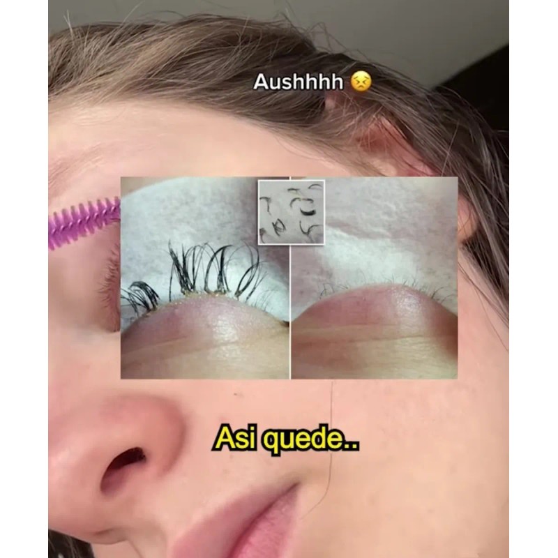 Versox Estimulador Crecimiento Pestañas Cejas