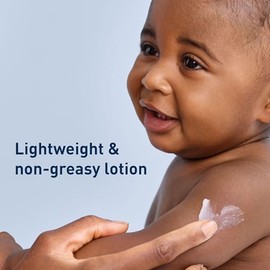 CeraVe Baby Lotion | Gentle Baby Skin Care with Ceramides, Niacinamide & Vitamin E | Fragrance, Paraben, Dye & Phthalates Free | Lightweight Baby Mois