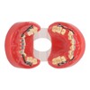 Professional Dental Demonstration Orthodontic Model with Metal Wires and Bracket