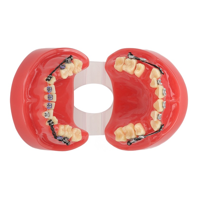 Professional Dental Demonstration Orthodontic Model with Metal Wires and Bracket