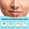 Parches para Acne,Pimple Patch, Parches para Espinillas, Almohadillas Hidrocoloides para