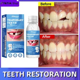 Resin Teeth Repair Glue – Moldable Temporary Tooth Filling & Broken Tooth Repair | Safe & Easy-to-Use Dental Gel for Gaps, False Teeth & Denture Fixing:_1pcs