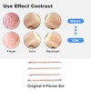 HaimiLiya Pimple Popper Tool Kit-4 Pcs Acne Needle Tools Set-