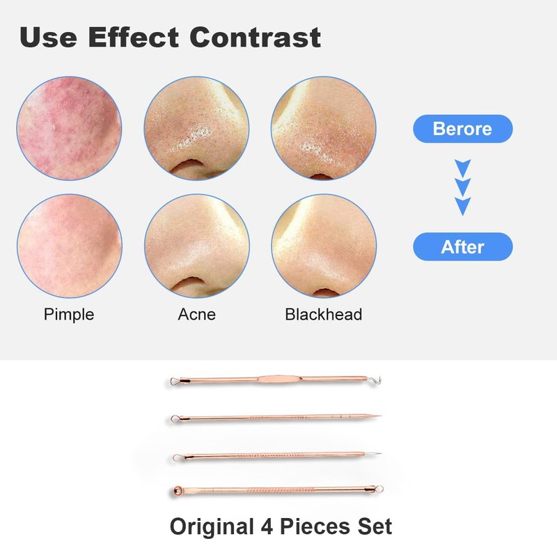 HaimiLiya Pimple Popper Tool Kit-4 Pcs Acne Needle Tools Set-