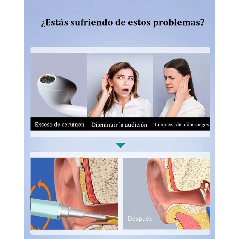 Suweazc Herramienta Con Cámara 1080p P/limpieza De Oído, 7 Piezas