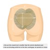 Sacral Foam Wound Dressing - Pressure Adhesive Pad for Elderly
