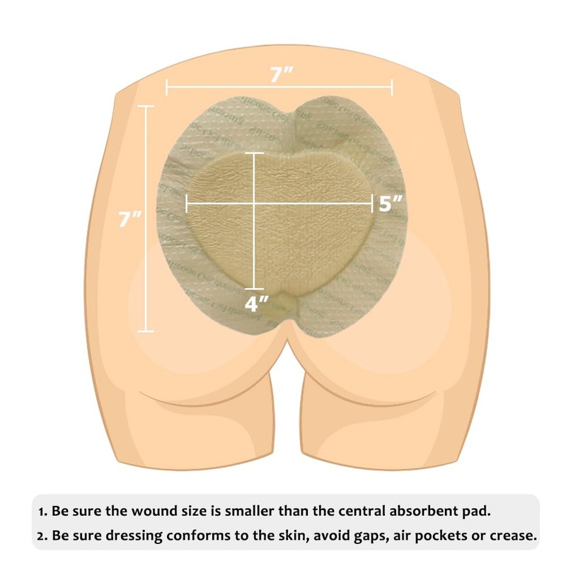 Sacral Foam Wound Dressing - Pressure Adhesive Pad for Elderly