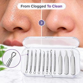 11-Piece Blackhead Remover Tool Set for Facial Care – Stainless Steel Extraction Kit for Home Skincare Routines