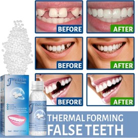 Moldable False Teeth,Temporary Tooth Filling Kit,Teeth Filling Replacement,Instant Tooth Filling Repair Kit,Thermal Forming False Teeth,Dental Repair Tools,Tooth Filler,DIY Fake Teeth Repair Beads
