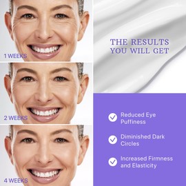 ESSENLIS Caffeine Eye Cream for Dark Circles and Puffiness, Bags Under Eyes, Collagen Anti Aging Day and Night Corrector for Women and Men (1)