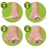 ZenToes Bunion Corrector Toe Separator Wraps Relieve Pain from Bunions