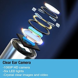 Tilcare Ear Wax Removal Tool with Ear Camera by Tilcare - Ear Irrigation Flushing System for Adults & Kids - Perfect Ear Cleaning Kit - Includes Basin, Syringe, Curette Kit, Towel and 30 Disposable Tips