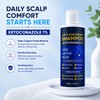 Ketoconazole 1% Anti-Dandruff Shampoo Itchy Scalp Flake Control 200ml