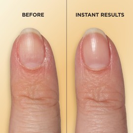 Sally Hansen Vitamin E Nail & Cuticle Treatment Pen | Hydrates and Conditions Dry Nails | Nourishing Formula with Apricot Oil | Smooth, Healthy-Looking Nails | Easy, Mess-Free Nail Care on the Go