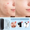Teenitor 7 in 1 Pimple Popper Tool Kit - Blackhead