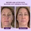 ACADA Anti Wrinkle Patches – Reusable Silicone Face Patches for