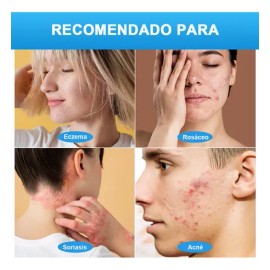 Crema De Cuidado Con Calamina Ts Ml Tt/psoriasis, Eccema, Urticar
