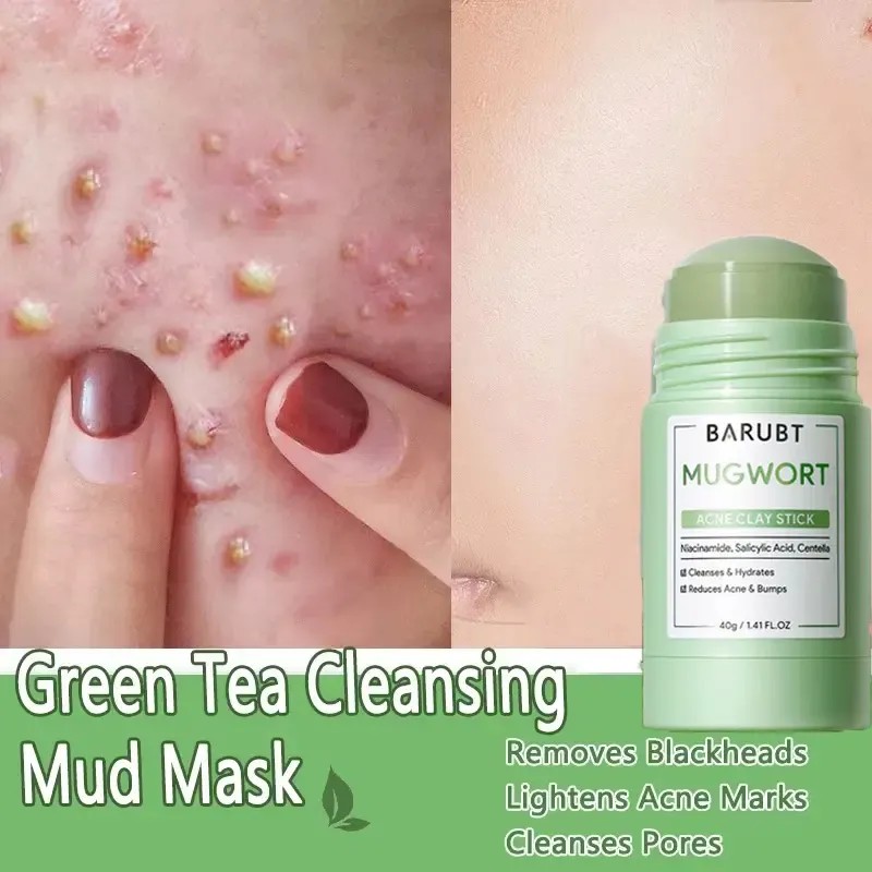 Mascarilla Sólida Limpia Poros Antiespinillas Control Grasa