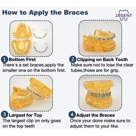 2 Pcs Temporary Tooth Decoration with Metal Wires Bracket Orthodontic Ligature Ties, Fashionable Colorful Fake Braces for Orthodontists Help Patients Understand Their Treatment (Mixed Colours)