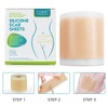 Medical Grade Silicone Scar Sheets, Silicone Scar Tape (1.6”x 60”),