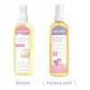 Mom Etapa Prevenir Estrías Aceite Comezón Neutra
