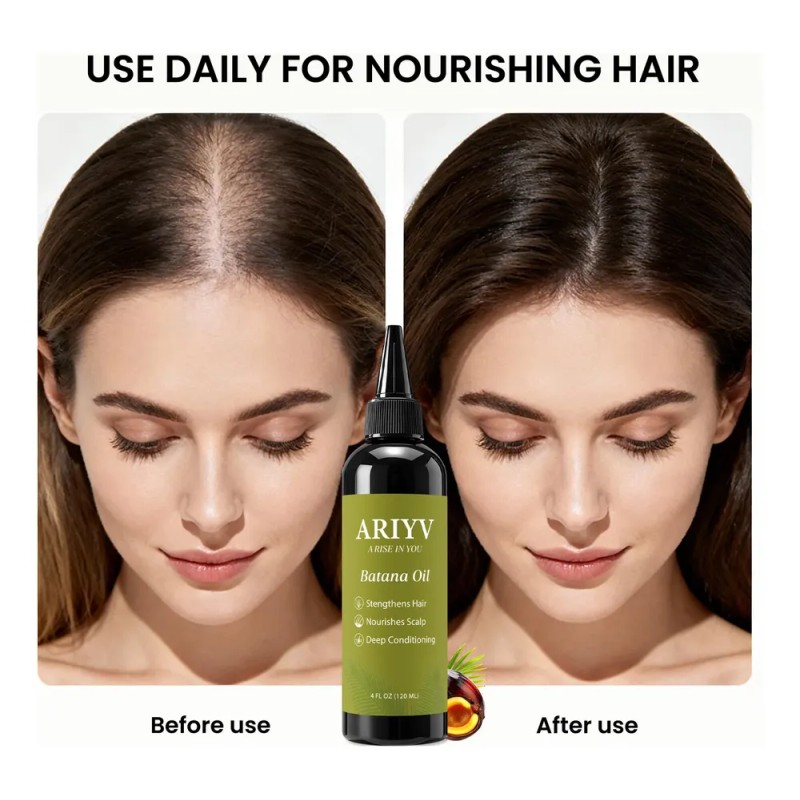 Aceite Ariyv Batana Para El Crecimiento Del Cabello